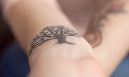 Old vs new tattoos for removal