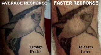 Freshly healed vs aged ink