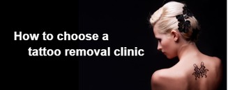 how to choose a tattoo removal clinic ink revoke how to choose a tattoo removal clinic ink revoke