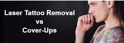 Tattoo cover up vs removal