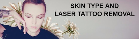 Tattoo Removal on Dark Skin