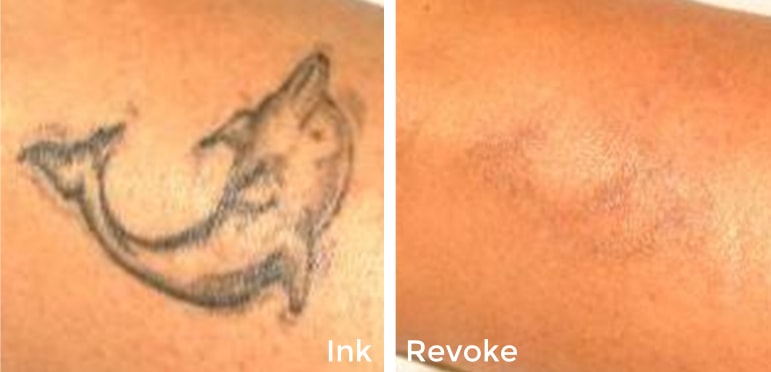 before after ink revoke before after ink revoke