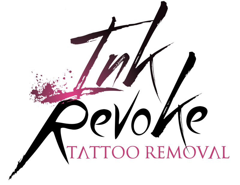 Ink Revoke Tattoo Removal